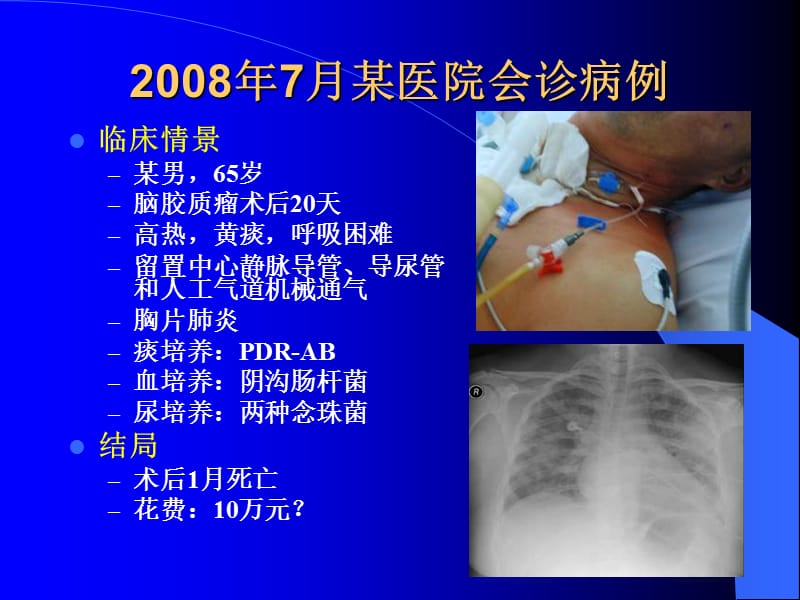 医院感染管理与控制-PPT文档.ppt_第3页