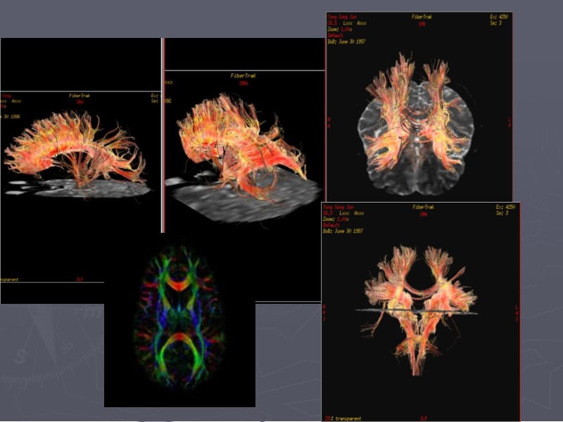 2018年DTI的基本原理及其在中枢神经系统中的应用-文档资料.ppt_第2页