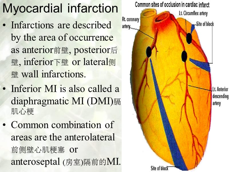 内科护理学课件 英语 考试资料myocardial+infarction-文档资料.ppt_第3页