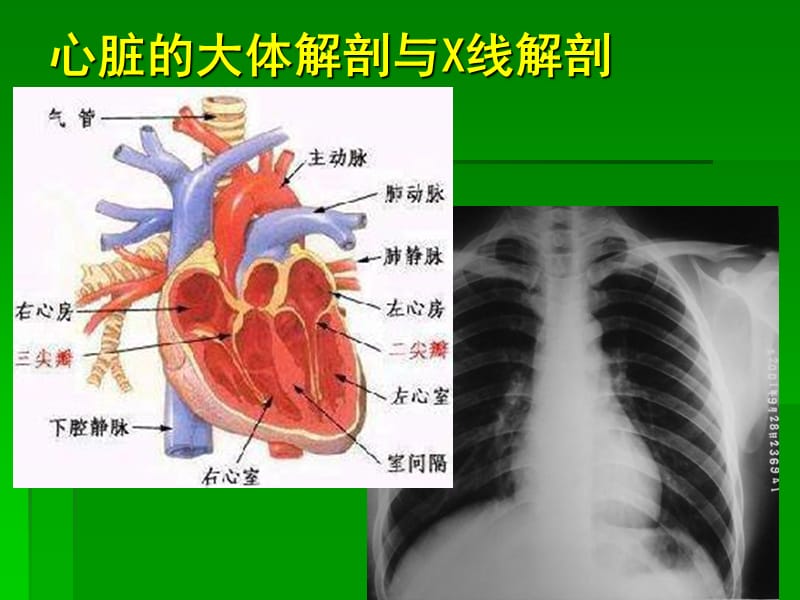 2018年扩展阅读纵隔心血管的解剖-文档资料.ppt_第3页