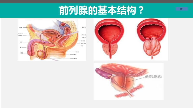 前列腺增生症标准课件课件-文档资料.ppt_第2页