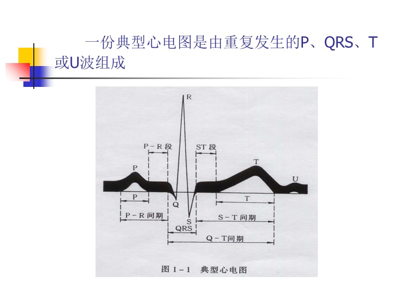 心电图名波段和间期命名1-精选文档.ppt_第1页