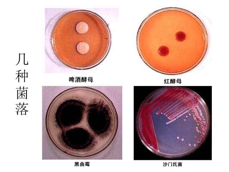 微生物放线菌与病毒-文档资料.ppt_第3页