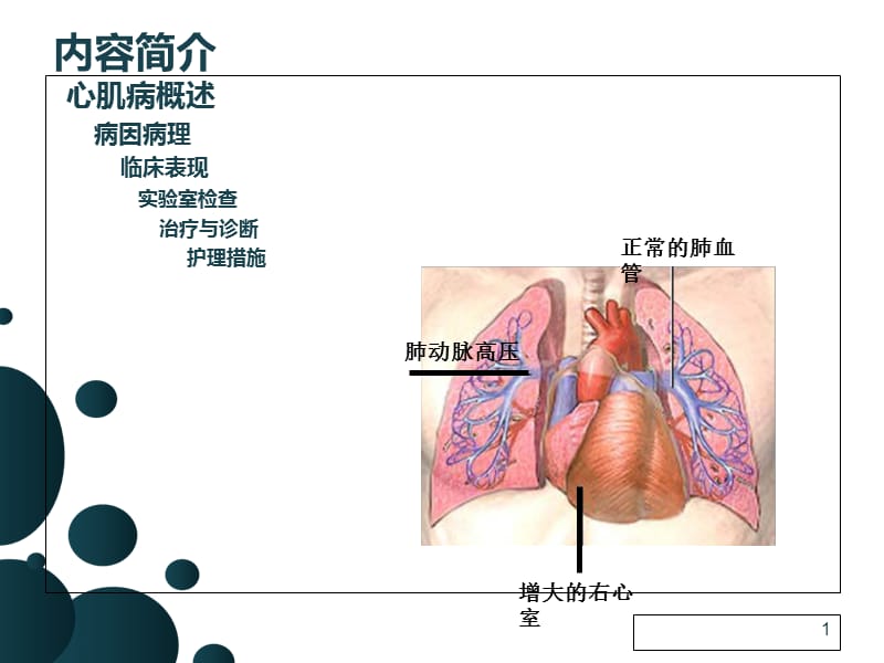 扩张性心肌病的护理查房张性1-精选文档.ppt_第1页