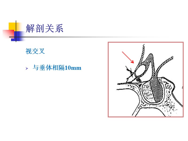 2018年垂体腺瘤与妊娠-文档资料.ppt_第3页