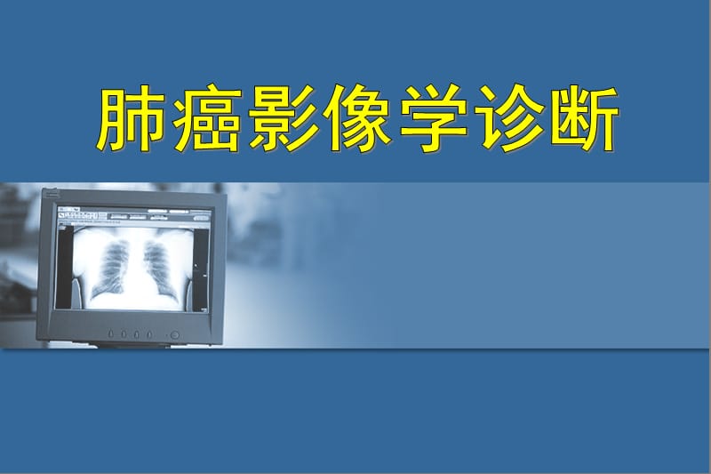 肺癌影像学诊断.ppt_第1页