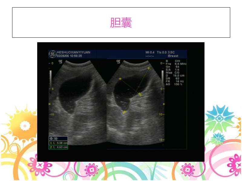 医学影像科B超心电图室服务项目-PPT文档.ppt_第3页