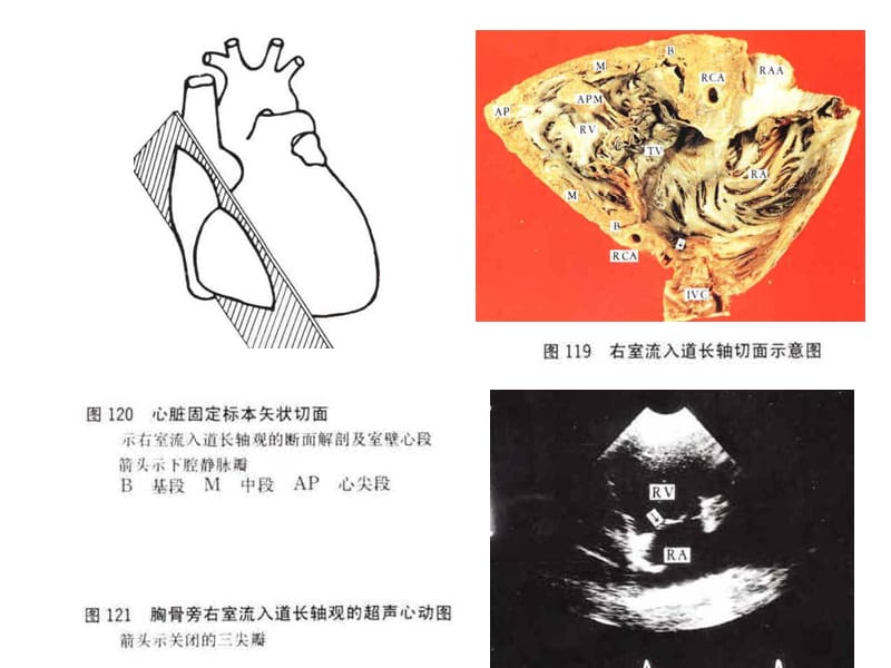 心脏超声和心脏断面解剖及室壁心段-PPT文档.ppt_第3页