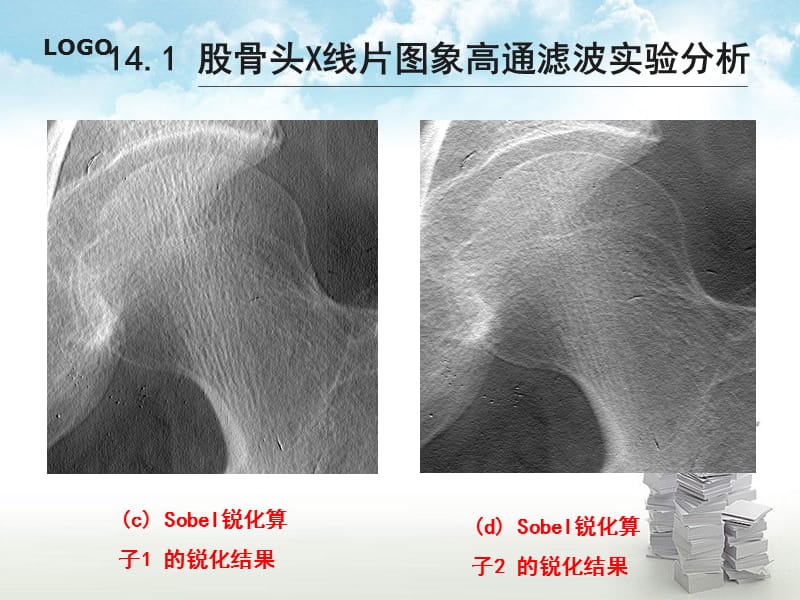 2018年第14章基于空域运算的快速股骨头X线片图象增强方法-文档资料.ppt_第2页