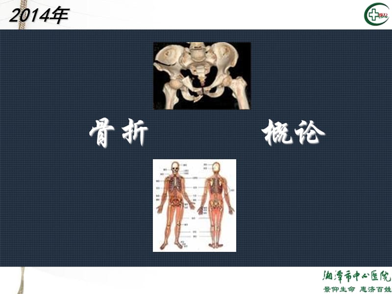 2018年xh骨折概论2-文档资料.ppt_第3页