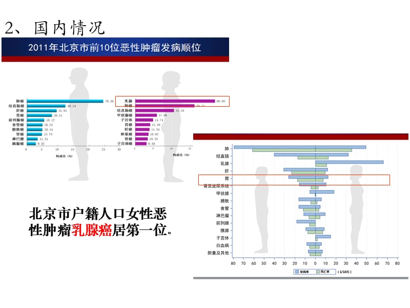 外科肿瘤乳腺癌ppt课件-精选文档.ppt_第3页