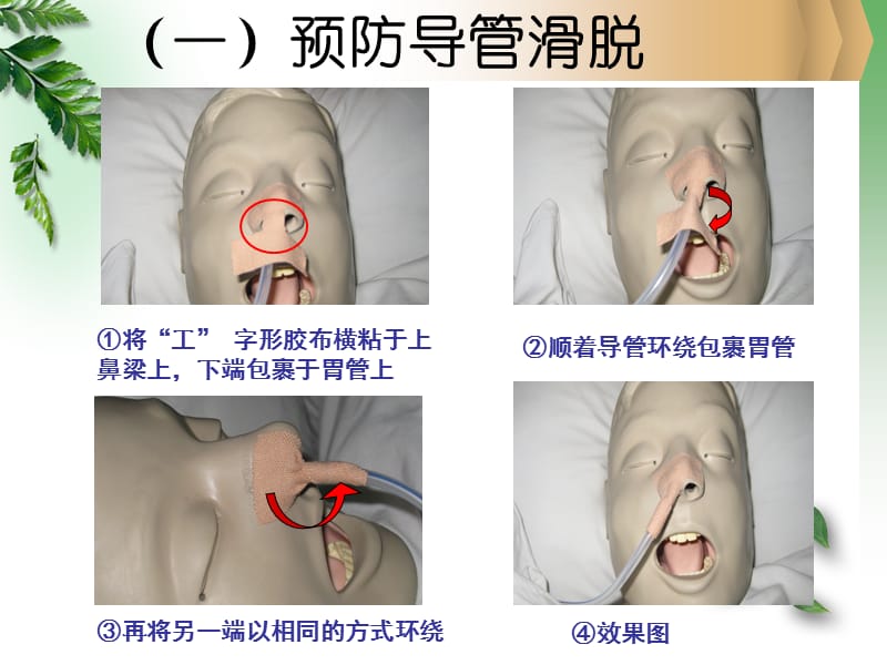 各类导管的护理111ppt课件-文档资料.ppt_第3页