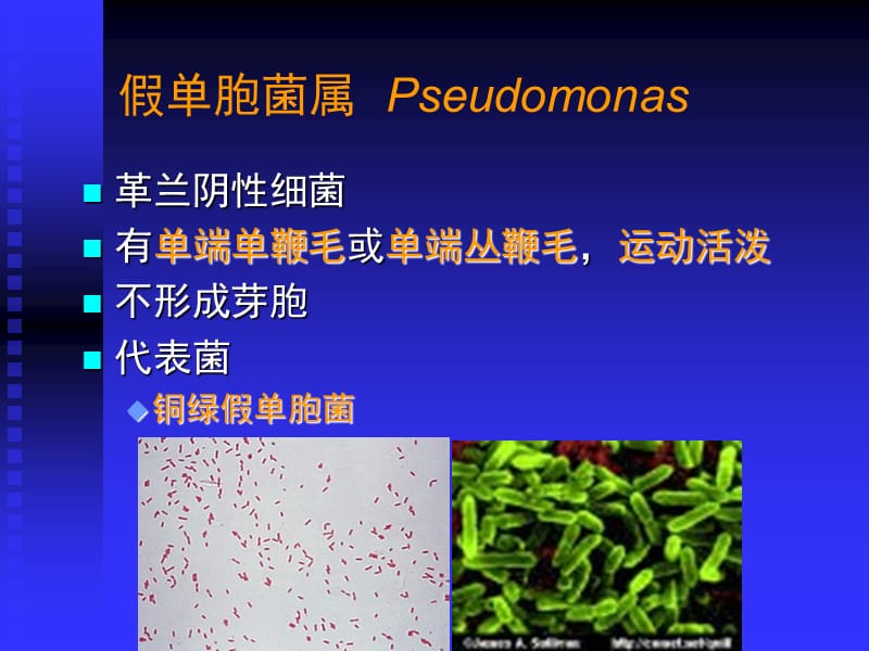 医学微生物学-致病性细菌-其他细菌-文档资料.ppt_第3页