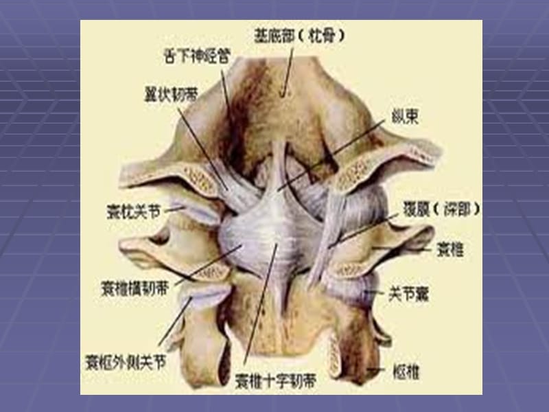 上颈椎损伤分类-PPT课件.ppt_第2页