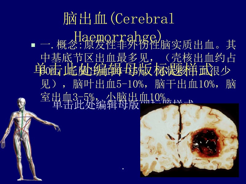 最新脑出血的诊断和治疗-PPT文档.ppt_第1页