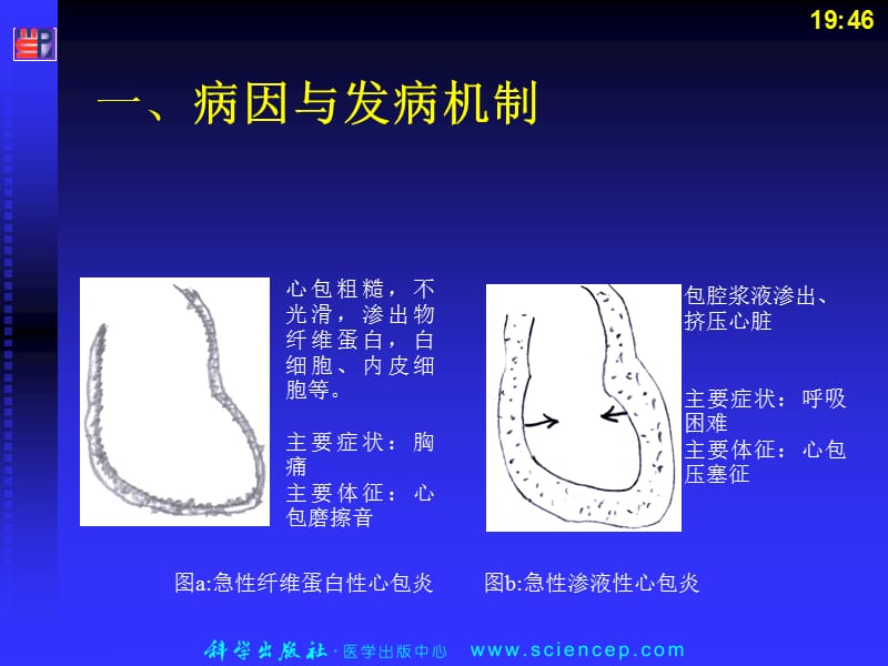 最新循环系统-第10节 心包疾病-PPT文档.ppt_第2页