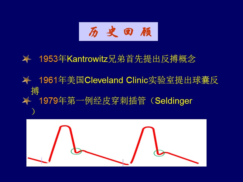 主动脉内球囊反搏泵-PPT文档.ppt_第1页