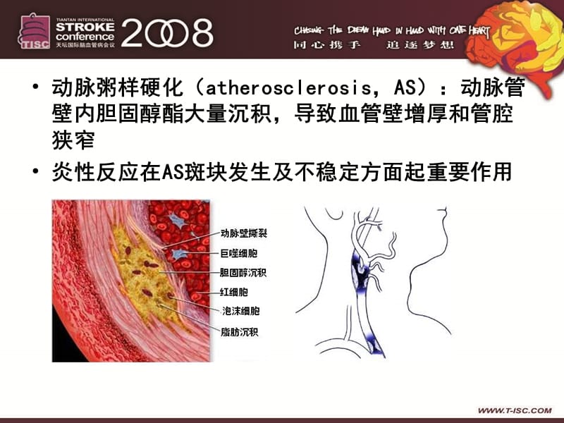 动脉粥样硬化与炎症-文档资料.ppt_第1页