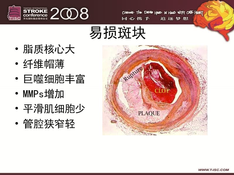 动脉粥样硬化与炎症-文档资料.ppt_第2页