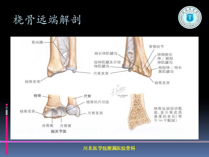 掌背侧钢板治疗桡骨远端骨折ppt课件-文档资料.ppt_第2页