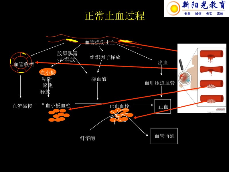 出血疾病-文档资料.ppt_第3页