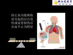 出血疾病-文档资料.ppt