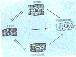 3细胞和组织的损伤与修复-PPT课件.ppt