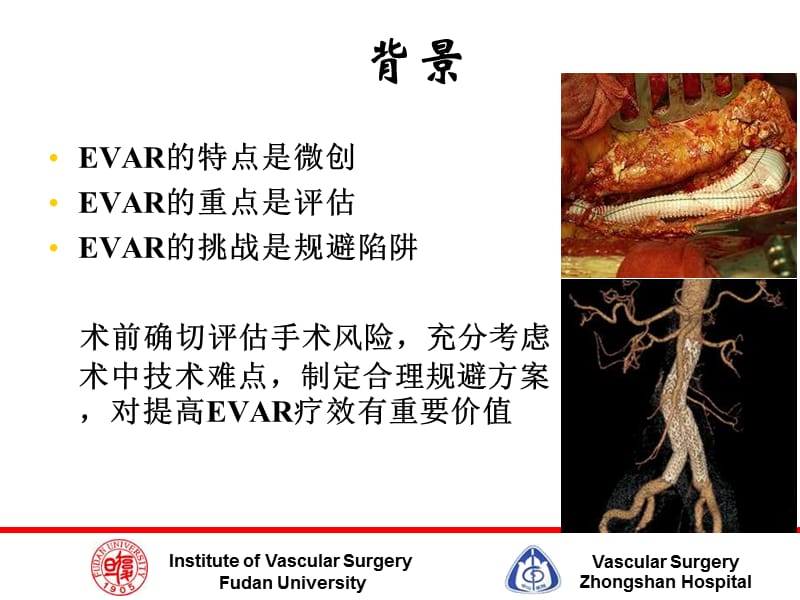 最新腹主动脉瘤EVAR术中陷阱及规避技巧-PPT文档.ppt_第2页