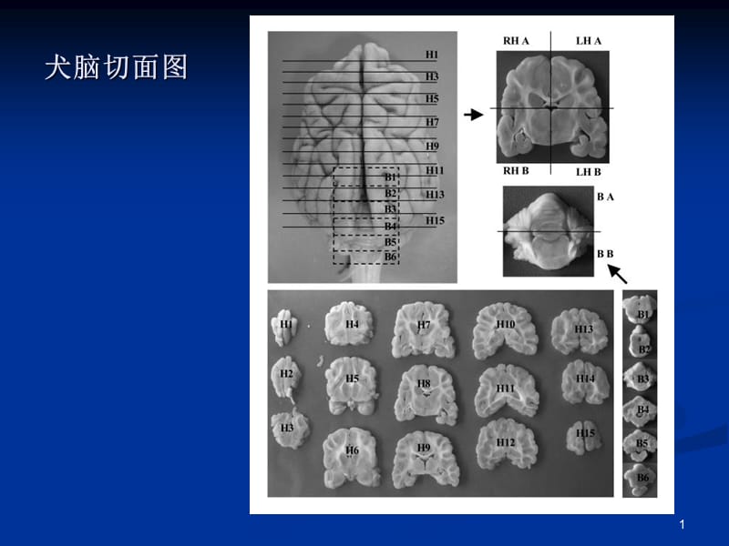 内科-神经系统-文档资料.ppt_第1页