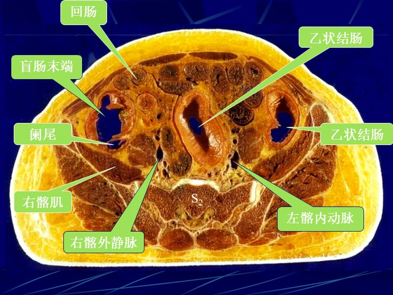 最新女性盆部断面解剖-PPT文档.ppt_第1页