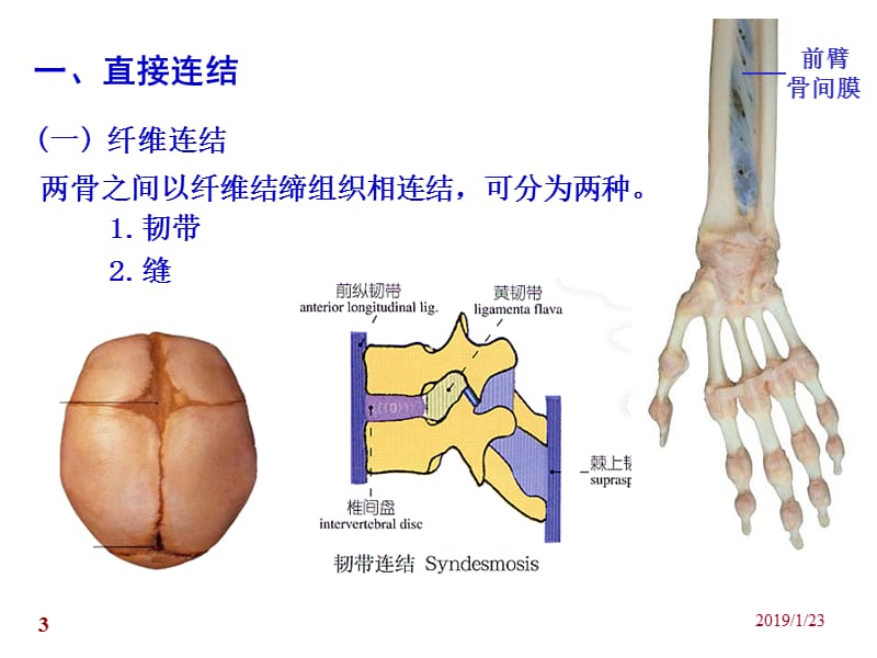 关节学-PPT课件.ppt_第3页