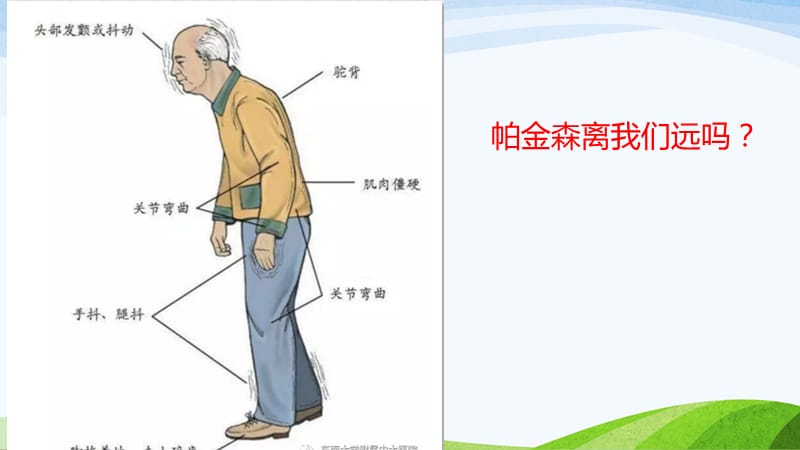 最新：帕金森病的康复ppt课件-文档资料.pptx_第2页