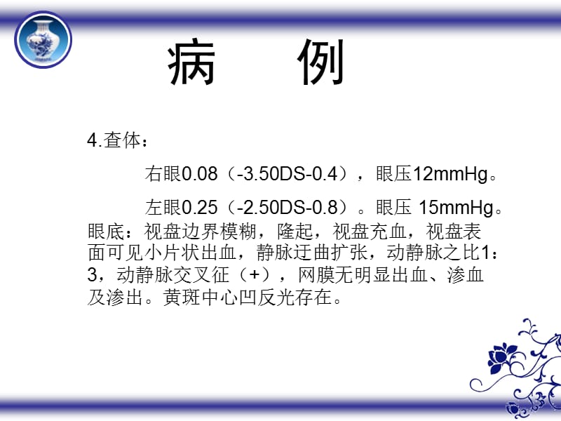 最新：《视神经炎》-文档资料.ppt_第3页