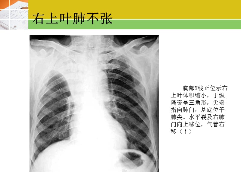 最新《常见疾病x片》ppt课件-PPT文档.ppt_第1页