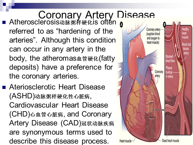 最新内科护理学课件 英语 考试资料Coronary+Artery+Disease(1)-PPT文档.ppt_第1页