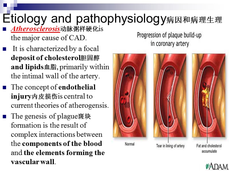 最新内科护理学课件 英语 考试资料Coronary+Artery+Disease(1)-PPT文档.ppt_第2页