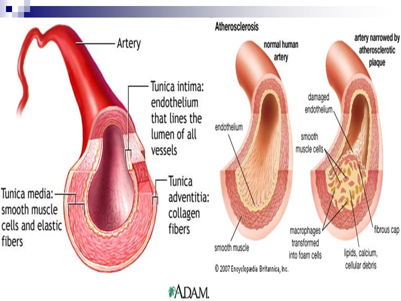 最新内科护理学课件 英语 考试资料Coronary+Artery+Disease(1)-PPT文档.ppt_第3页