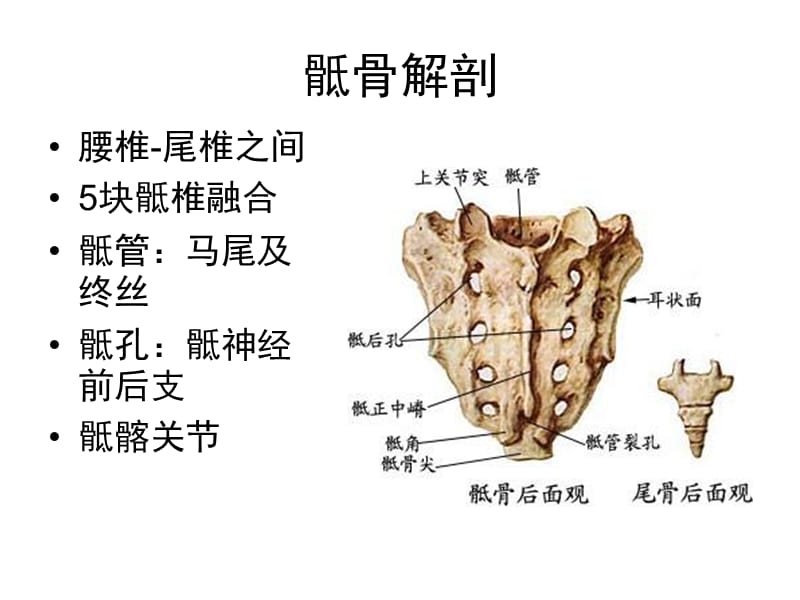 最新：《骶骨肿瘤》ppt课件(2)-文档资料.ppt_第1页