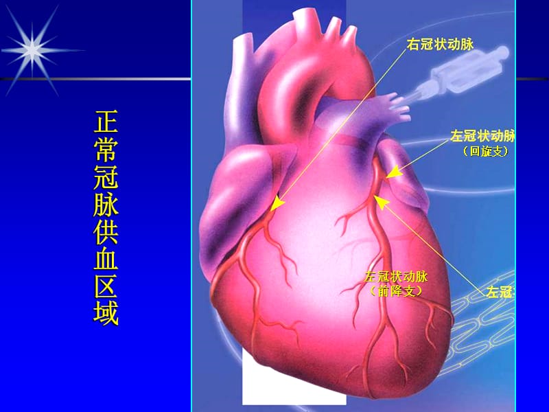 最新冠性病诊断与治疗 冠状动脉粥样硬化性心脏病(CORONARY-PPT文档.ppt_第1页