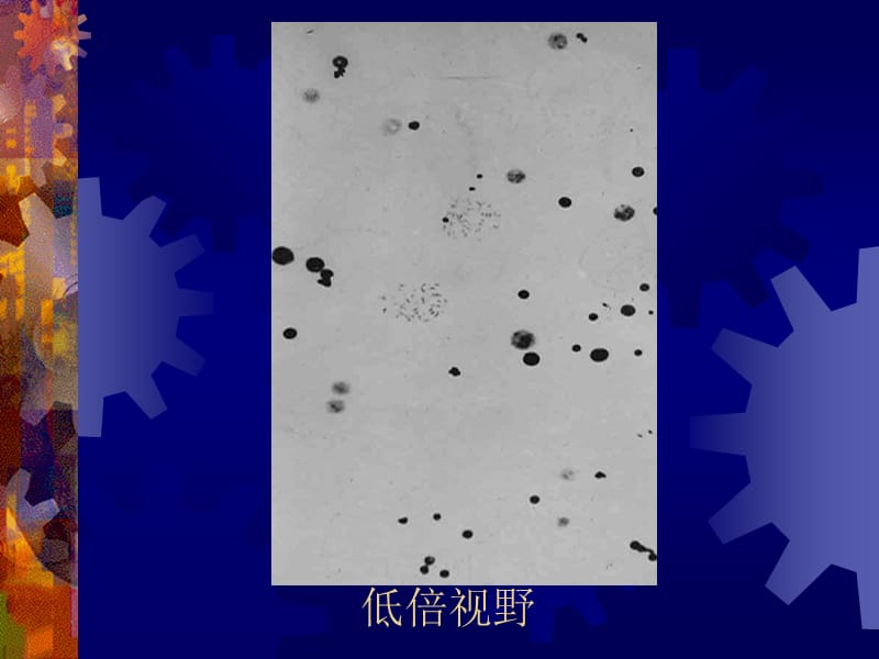 9人类染色体畸变及疾病-PPT课件.ppt_第1页