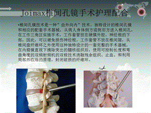 最新：joimax椎间孔镜手术护理配合-文档资料.ppt