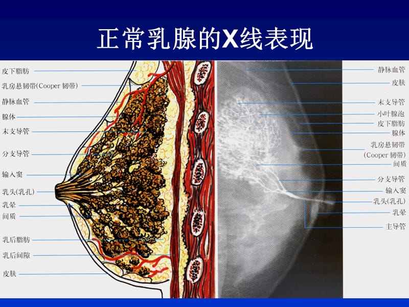 全数字化乳腺机的临床应用-PPT文档.ppt_第1页