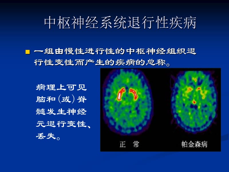 中枢神经系统退行性疾病-PPT课件.ppt_第2页