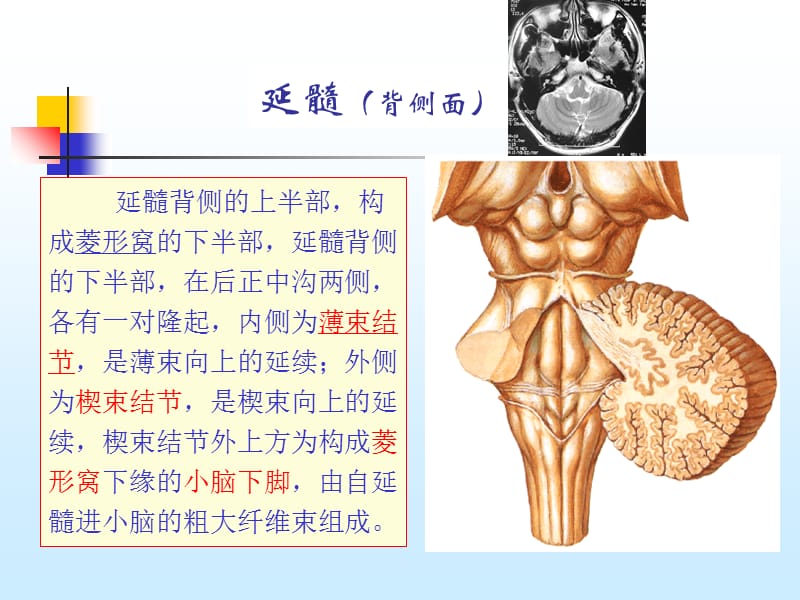 最新脑干与小脑解剖结构功能-PPT文档.ppt_第3页