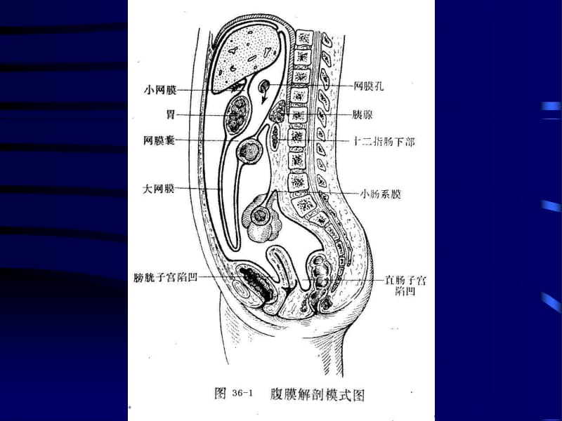 最新化脓性腹膜炎分析课件-PPT文档.ppt_第3页