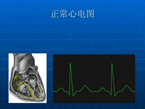 最新恶性心律失常的识别-PPT文档.ppt