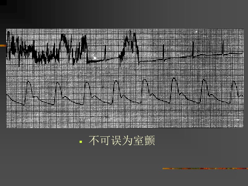 最新：ICU血液动力学监测-文档资料.ppt_第3页