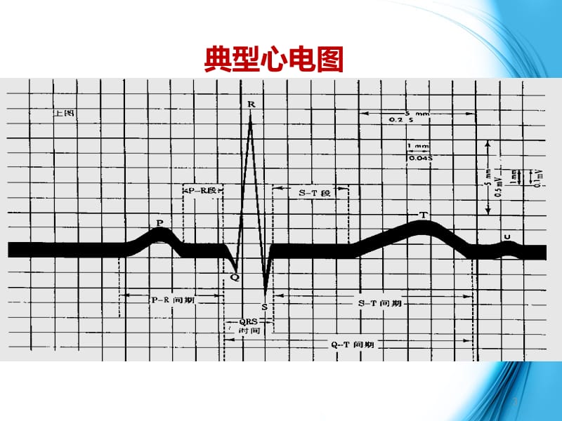 最新：《初识心电图》-文档资料.ppt_第3页