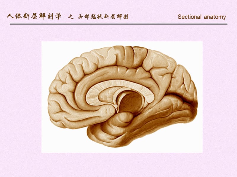 人体断面解剖学-头部冠状断层解剖-精选文档.ppt_第2页