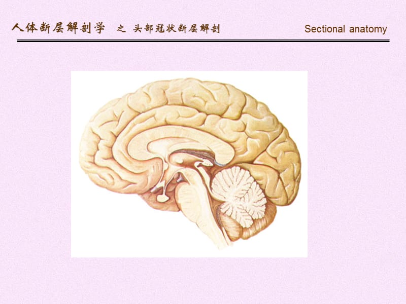 人体断面解剖学-头部冠状断层解剖-精选文档.ppt_第3页